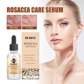 OUHOE Erythematous Essence, Skin Lighten Facial Erythematous Moisturizing Essential Oil
